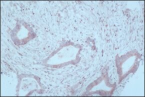 Merck MONOCLONAL ANTI-TRYPTOPHAN HYDROXYLASE,&