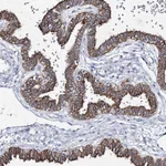 Atlas Antibodies Anti-ADGRL1 Antibody