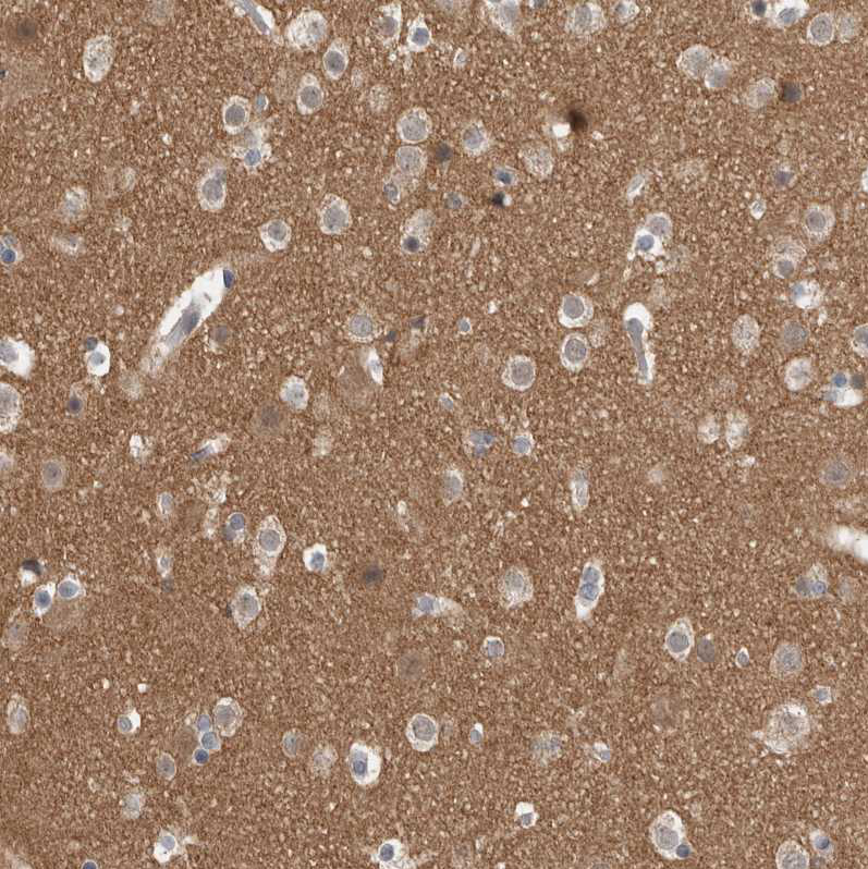 Atlas Antibodies Anti-ADGRL3 Antibody