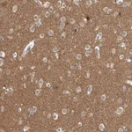 Atlas Antibodies Anti-ADGRL3 Antibody