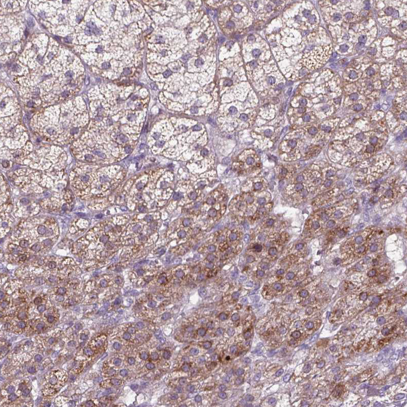 Atlas Antibodies Anti-ADGRV1 Antibody