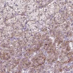 Atlas Antibodies Anti-ADGRV1 Antibody