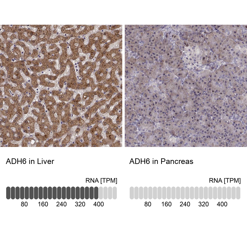 Atlas Antibodies Anti-ADH6 Antibody