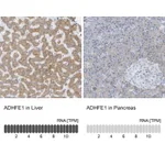 Atlas Antibodies Anti-ADHFE1 Antibody