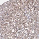 Atlas Antibodies Anti-ADH1A Antibody