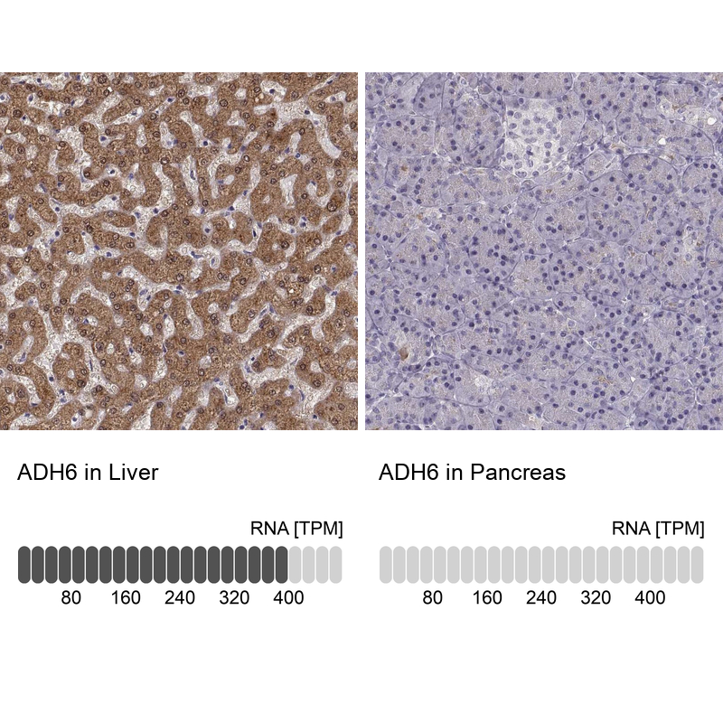 Atlas Antibodies Anti-ADH6 Antibody