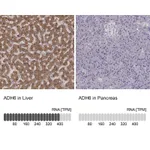 Atlas Antibodies Anti-ADH6 Antibody