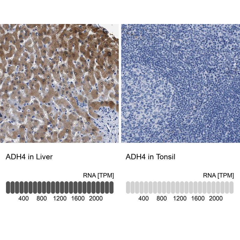 Atlas Antibodies Anti-ADH4 Antibody