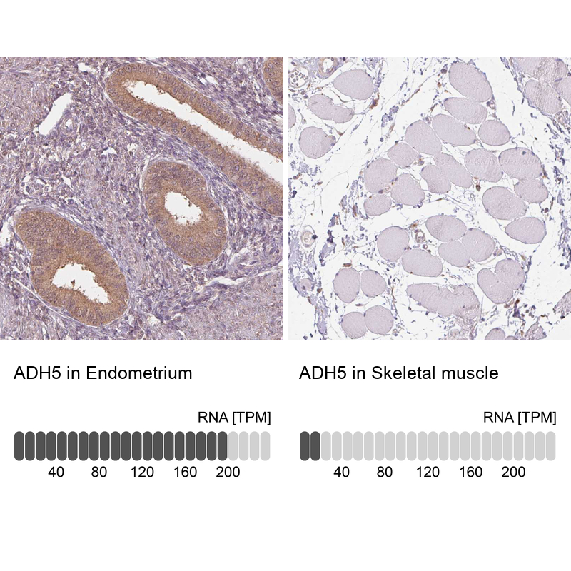 Atlas Antibodies Anti-ADH5 Antibody