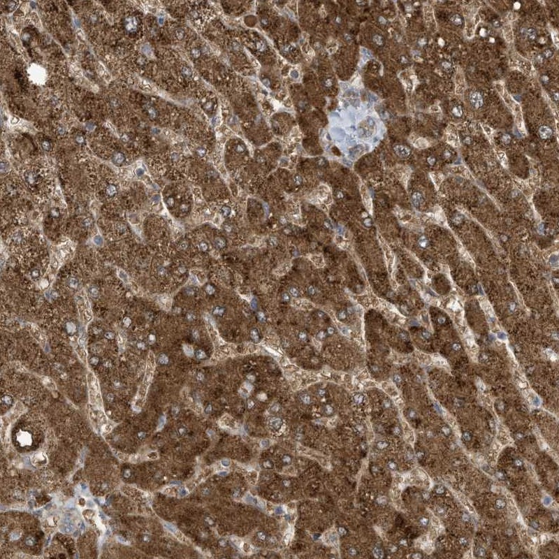 Atlas Antibodies Anti-ADI1 Antibody