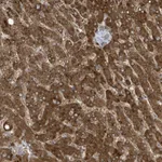 Atlas Antibodies Anti-ADI1 Antibody