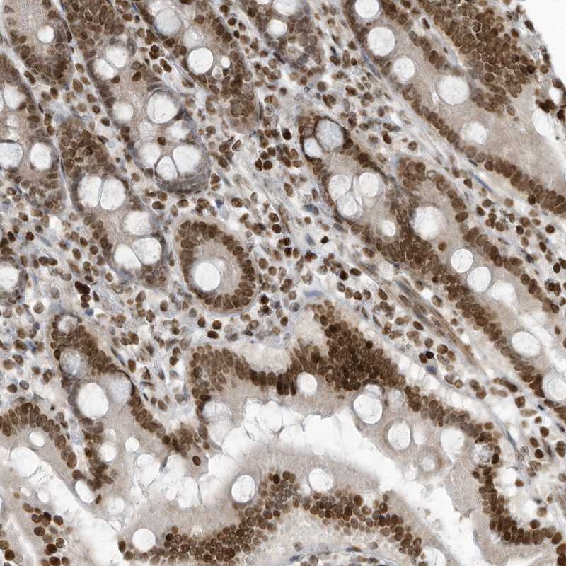 Atlas Antibodies Anti-ADI1 Antibody
