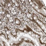 Atlas Antibodies Anti-ADI1 Antibody