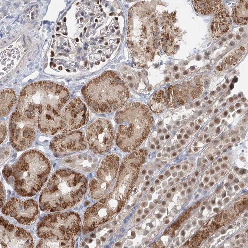 Atlas Antibodies Anti-ADK Antibody