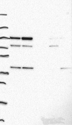 Atlas Antibodies Anti-ADK Antibody