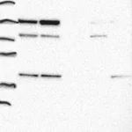 Atlas Antibodies Anti-ADK Antibody