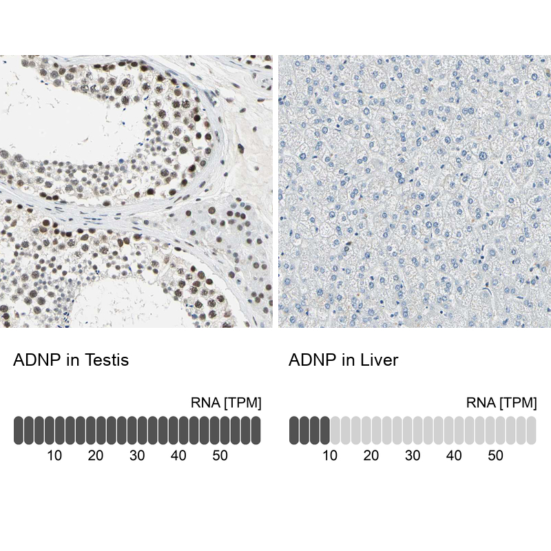 Atlas Antibodies Anti-ADNP Antibody