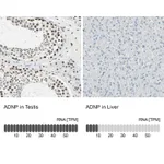 Atlas Antibodies Anti-ADNP Antibody