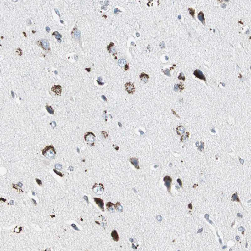 Atlas Antibodies Anti-ADNP2 Antibody