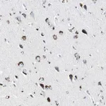 Atlas Antibodies Anti-ADNP2 Antibody