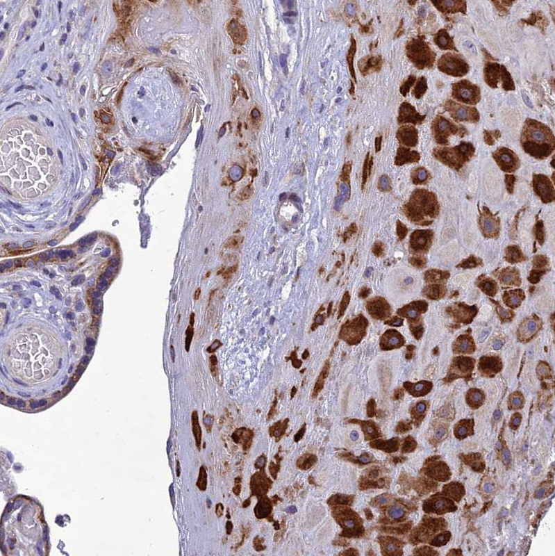 Atlas Antibodies Anti-ADIPOR2 Antibody