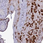 Atlas Antibodies Anti-ADIPOR2 Antibody