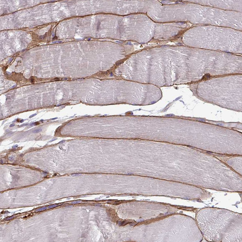 Atlas Antibodies Anti-ADIPOQ Antibody