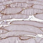 Atlas Antibodies Anti-ADIPOQ Antibody