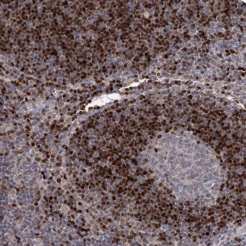 Atlas Antibodies Anti-ADK Antibody
