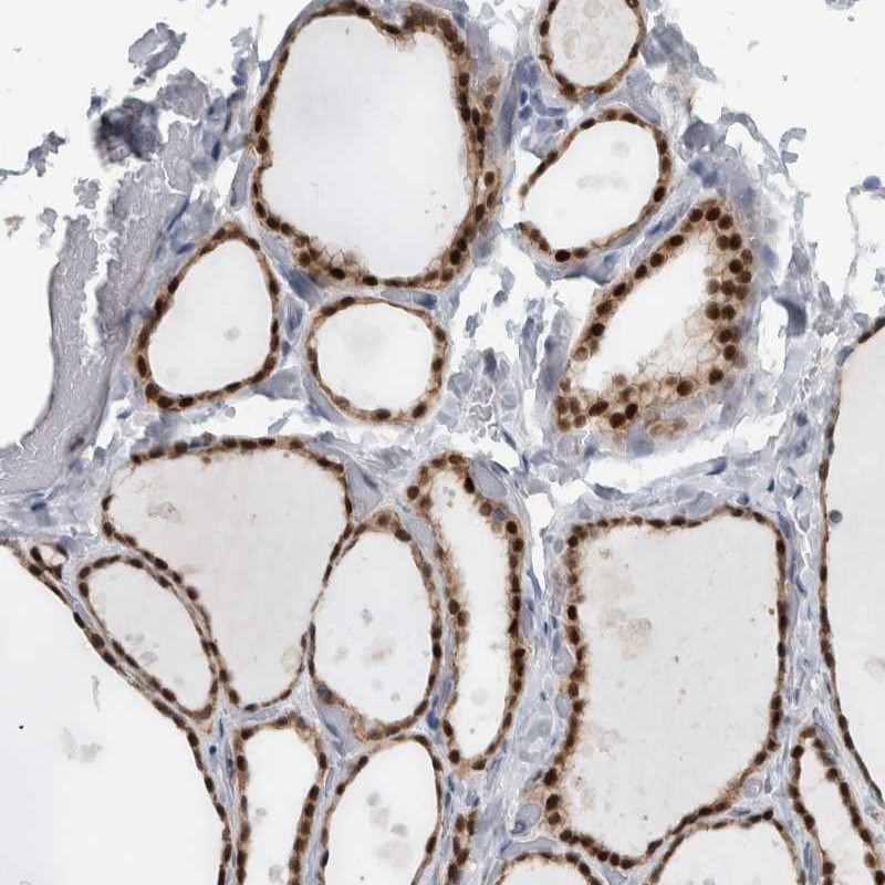 Atlas Antibodies Anti-ADPRM Antibody
