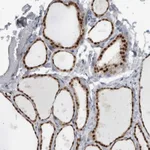 Atlas Antibodies Anti-ADPRM Antibody