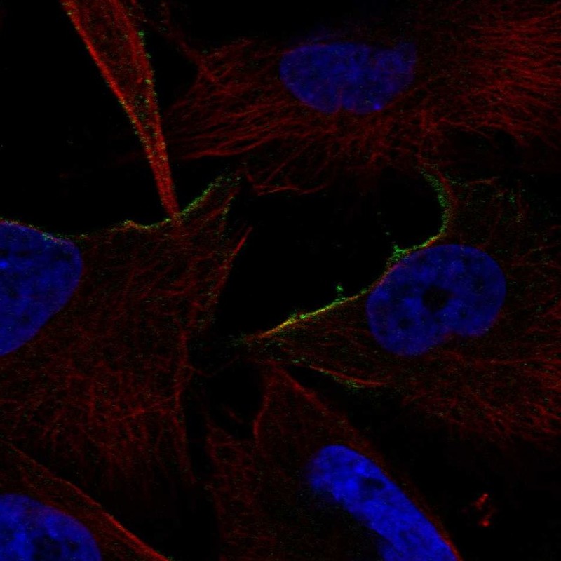 Atlas Antibodies Anti-ADRA1B Antibody