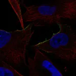 Atlas Antibodies Anti-ADRA1B Antibody