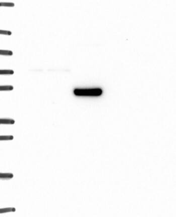 Atlas Antibodies Anti-ADRA1A Antibody