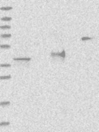 Atlas Antibodies Anti-ADPRS Antibody