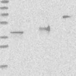 Atlas Antibodies Anti-ADPRS Antibody