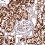 Atlas Antibodies Anti-ADRA1D Antibody