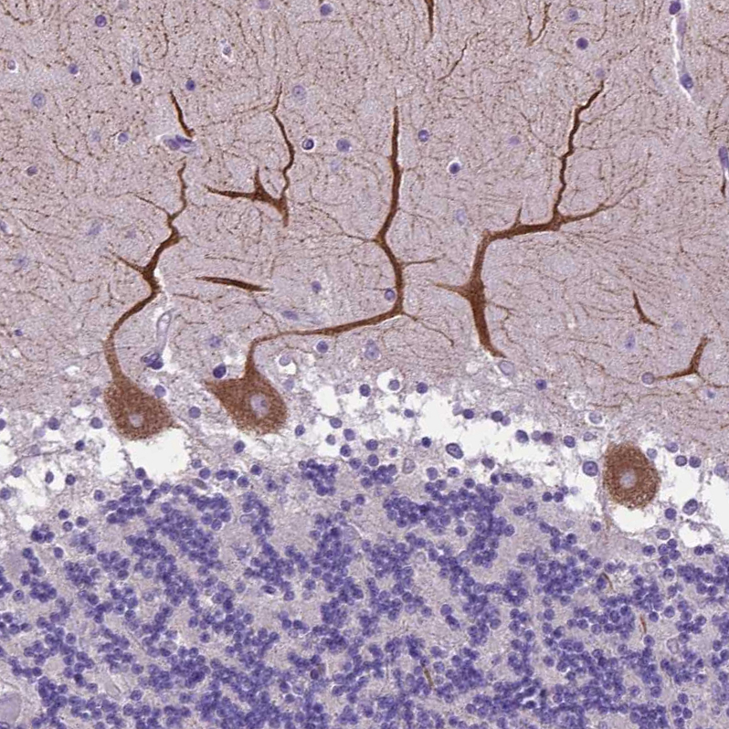 Atlas Antibodies Anti-ADRA2B Antibody