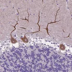 Atlas Antibodies Anti-ADRA2B Antibody