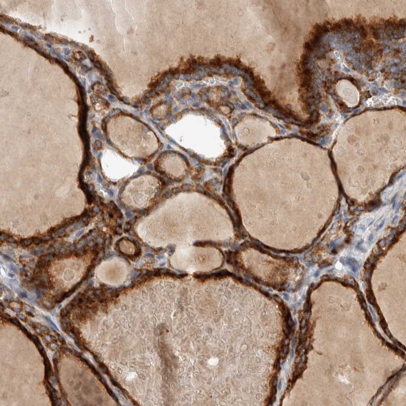 Atlas Antibodies Anti-ADPRM Antibody