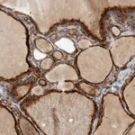 Atlas Antibodies Anti-ADPRM Antibody