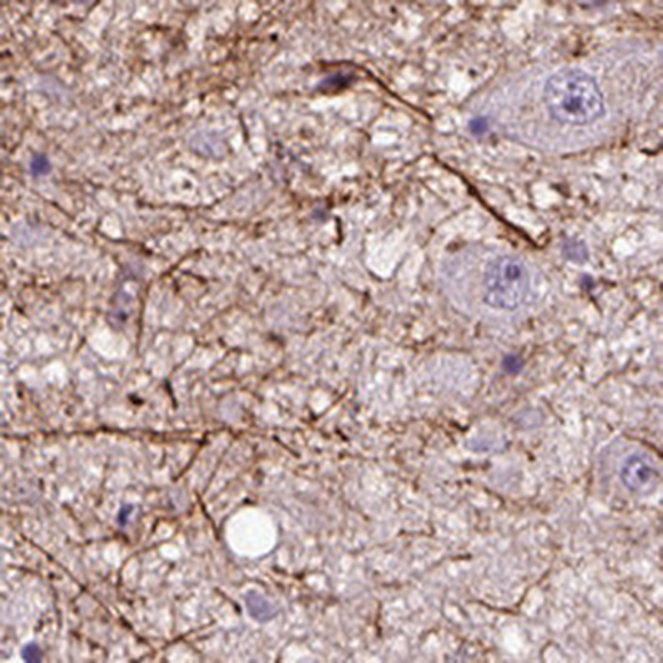 Atlas Antibodies Anti-ADRB3 Antibody