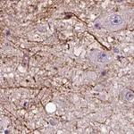Atlas Antibodies Anti-ADRB3 Antibody