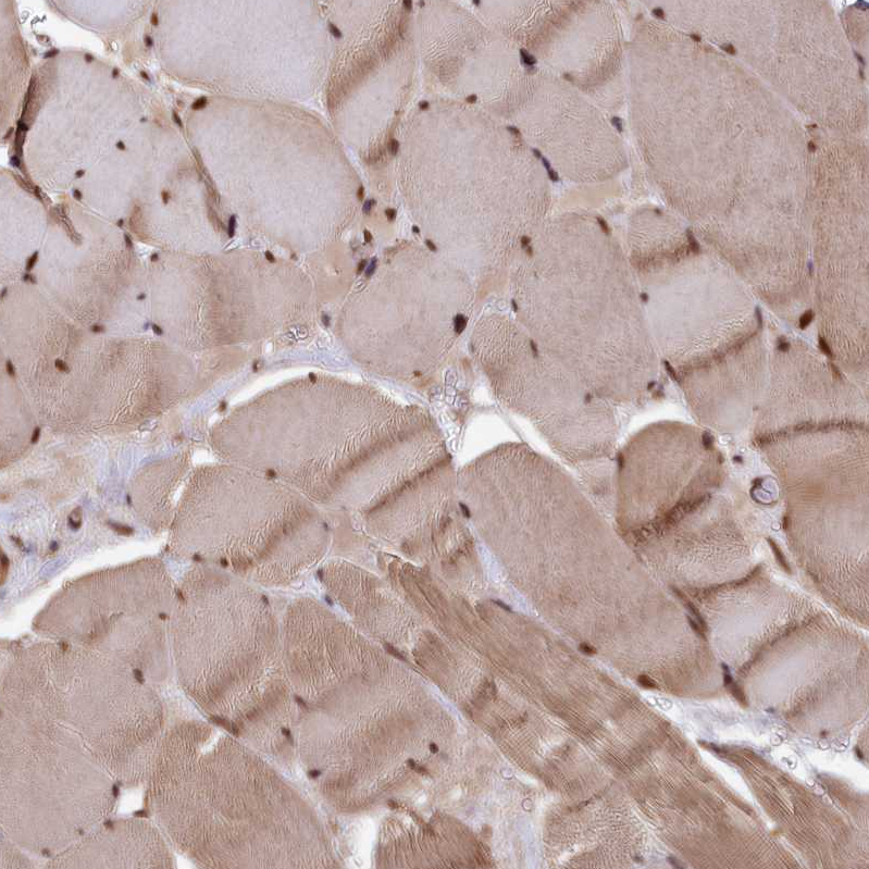 Atlas Antibodies Anti-ADRM1 Antibody