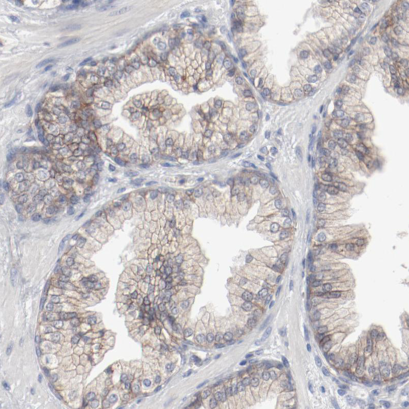 Atlas Antibodies Anti-ADRB2 Antibody