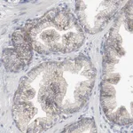 Atlas Antibodies Anti-ADRB2 Antibody