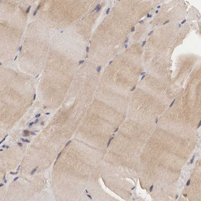 Atlas Antibodies Anti-ADSL Antibody