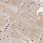 Atlas Antibodies Anti-ADSL Antibody