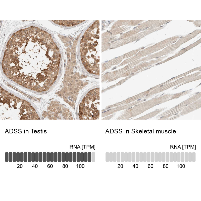 Atlas Antibodies Anti-ADSS Antibody