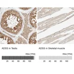 Atlas Antibodies Anti-ADSS Antibody